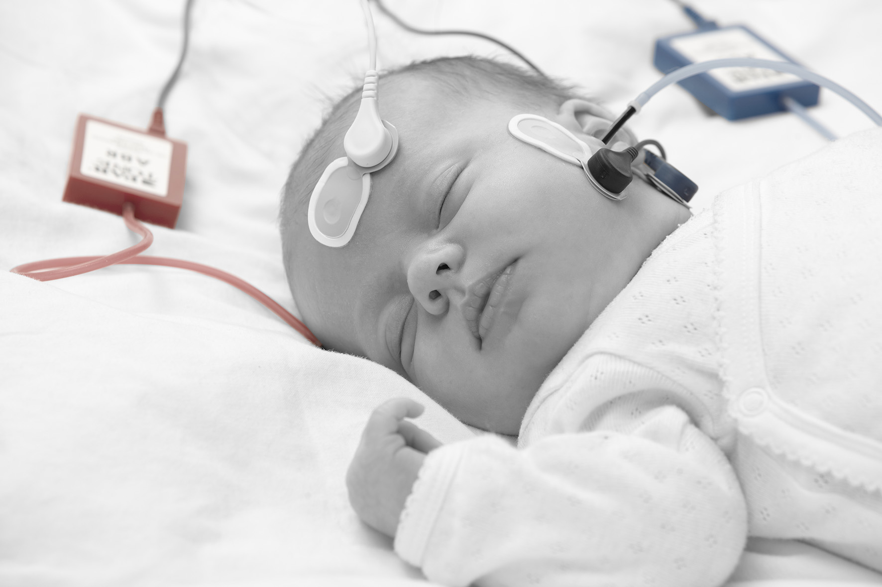 AABR newborn hearing screening