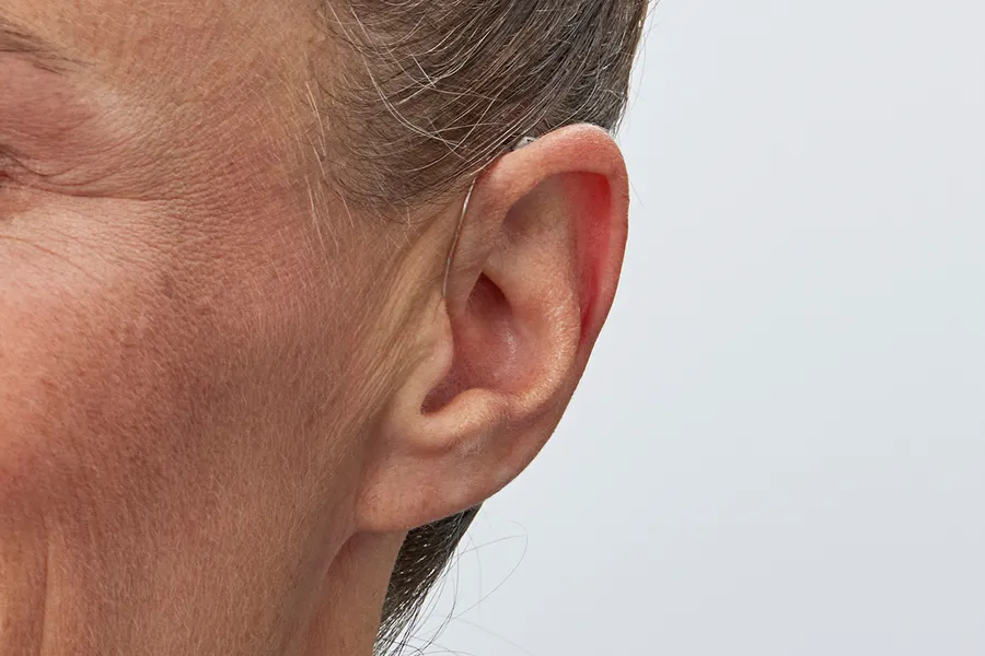 oticon intent minirite